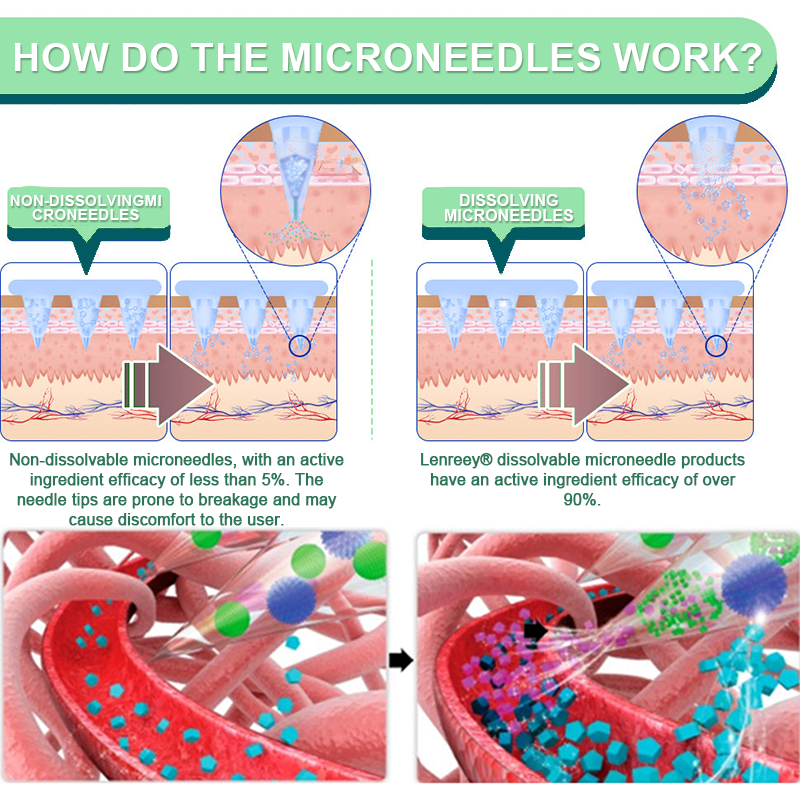 【Last Day Promotion 60% OFF👨⚕️】Lenreey® NIDDK-Tirzepatide Slimming & health NANO MICRONEEDLE PATCH🇺🇸👨⚕️(Zero Pain, 24/7 Release | Lose 20lbs FAST | 90% Sugar Drop | )