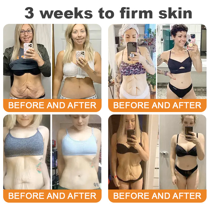 Turonu®🇺🇸 Bee Venom Multi-Care Repair Cream | See Results in Just 7 Days – Breast Firming | Wrinkle Reduction | Skin Tightening! ✅