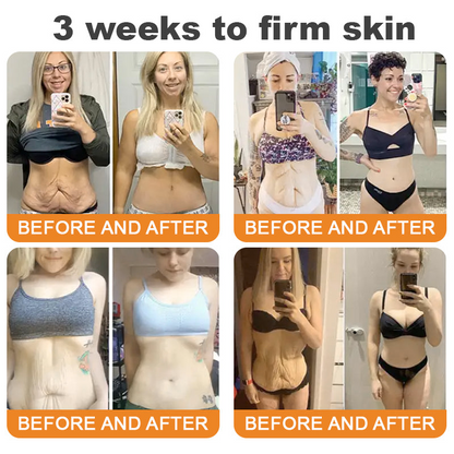 Turonu®🇺🇸 Bee Venom Multi-Care Repair Cream | See Results in Just 7 Days – Breast Firming | Wrinkle Reduction | Skin Tightening! ✅