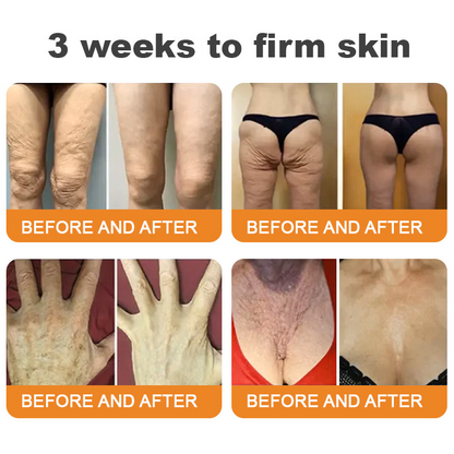 Turonu®🇺🇸 Bee Venom Multi-Care Repair Cream | See Results in Just 7 Days – Breast Firming | Wrinkle Reduction | Skin Tightening! ✅