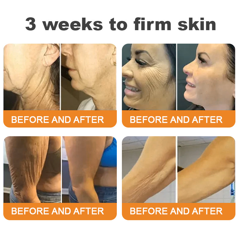 Turonu®🇺🇸 Bee Venom Multi-Care Repair Cream | See Results in Just 7 Days – Breast Firming | Wrinkle Reduction | Skin Tightening! ✅