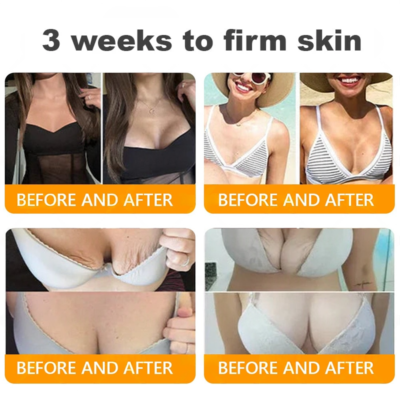 Turonu®🇺🇸 Bee Venom Multi-Care Repair Cream | See Results in Just 7 Days – Breast Firming | Wrinkle Reduction | Skin Tightening! ✅