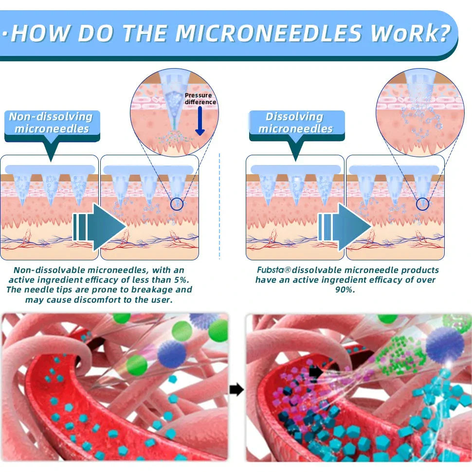 【Lmipki® Official Store】 NIDDK-Tirzepatide Nano Microneedle Patch 🇺🇸🏥（Zero Pain, 24/7 Release | Lose 20lbs FAST | 90% Sugar Drop | ）